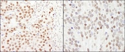 GTF3C5 Antibody, Novus Biologicals 0.1mL; Unlabeled:Antibodies, Polyclonal
